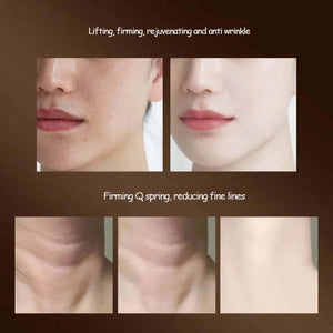 Dispositivo de Lifting Facial para Pescoço, Massagem Facial e Ocular, Introduzidor de Microcorrente, Rejuvenescimento da Pele, Antienvelhecimento, Dispositivo de Beleza, Massageador Facial