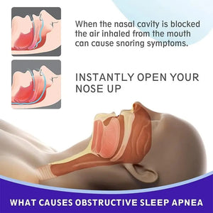 30Pcs Novas Tiras Nasais Hipoalergênicas Respirável Congestão Nasal Tirar de Nariz Não Invasivas Alívio Melhor Respiração