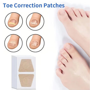 Adesivos para Unhas com Fungos para Reparação de Unhas, Adesivos para Correção de Unhas Encravadas para Unhas Descoloridas e Danificadas, Adesivo para Cuidado das Unhas
