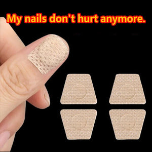 Adesivos para Unhas com Fungos para Reparação de Unhas, Adesivos para Correção de Unhas Encravadas para Unhas Descoloridas e Danificadas, Adesivo para Cuidado das Unhas