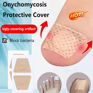 Adesivos para Unhas com Fungos para Reparação de Unhas, Adesivos para Correção de Unhas Encravadas para Unhas Descoloridas e Danificadas, Adesivo para Cuidado das Unhas