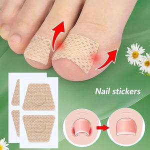 Adesivos para Unhas com Fungos para Reparação de Unhas, Adesivos para Correção de Unhas Encravadas para Unhas Descoloridas e Danificadas, Adesivo para Cuidado das Unhas