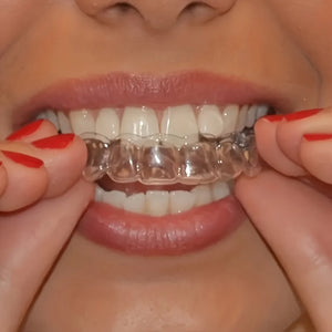 1-4 pares de Alinhadores de Dentes Unissex de Silicone Invisível, Bandeja Ortopédica Dental para Clareamento e Endireitamento, Uso Noturno, Ferramenta de Cuidado Dental